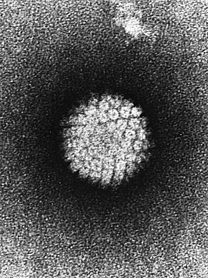 HPVirus - Elektronenmikroskop
